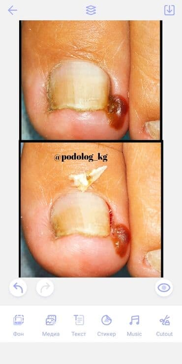 сколько стоит обучение на маникюр: Выравнивание, Наращивание ногтей, Донаращивание ногтей, Маникюр, Педикюр, Услуги подолога, Консультация, Одноразовые расходные материалы — 4