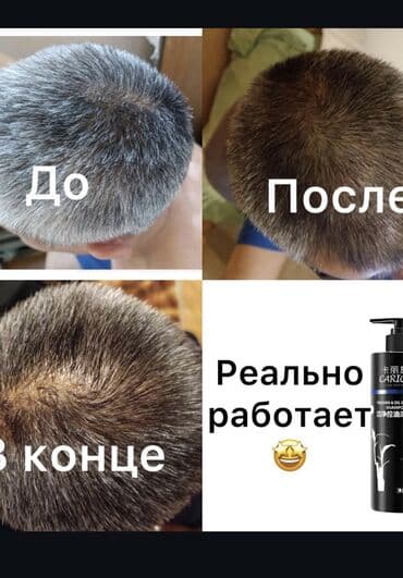 эко спрей от вшей как пользоваться: CARICH — шампуни для ежедневного ухода краска шампунь Варианты: - — 1