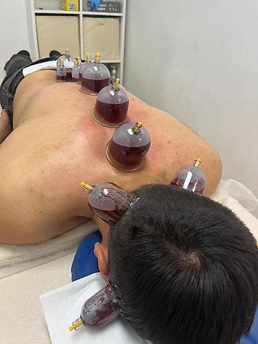 набор для хиджамы: Услуга: хиджама для мужчин Что предлагается: - Профессиональная — 3