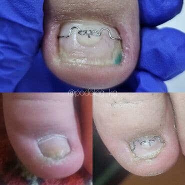 сколько стоит обучение на мастера маникюра: Выравнивание, Наращивание ногтей, Донаращивание ногтей, Маникюр, Педикюр, Услуги подолога, С выездом на дом, Консультация, Одноразовые расходные материалы — 1