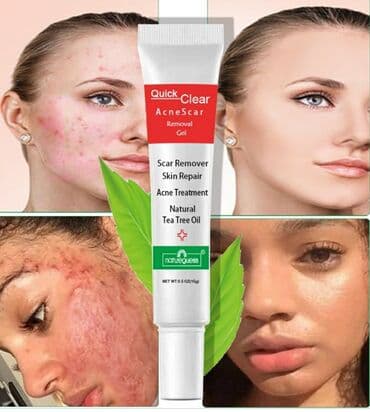 крем для отбеливания кожи и устранения пигментных пятен: Крем для лица Quick Clear с масло чайного дерева. От акне, шрамов — 2
