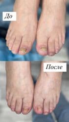 арендовать дом: Выравнивание, Услуги подолога, С выездом на дом, Консультация, Одноразовые расходные материалы — 37