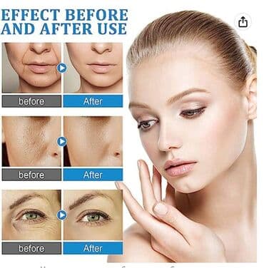 гиалуроновая кислота для суставов бишкек: ❄️ США Шоковое антивозрастное средство - гиалуроновая кислота — 7