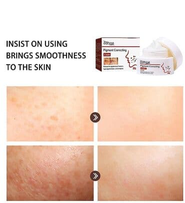 эффективный отбеливающий крем для зоны бикини в аптеке: США Крем отбеливающий для удаления мелазмы осветления кожи удаления — 15