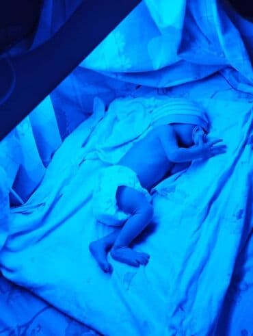 Кычкылтек концентратору: Аренда фотолампы от желтушки для новорожденных. 💛 Почему выбирают — 2