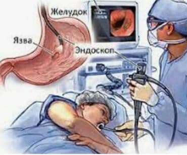 самый лучший гинеколог в бишкеке: Гастроскопия. Колоноскопия. Безболезненно+введение желчи. Доктор с — 1