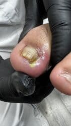 арендовать дом: Выравнивание, Услуги подолога, С выездом на дом, Консультация, Одноразовые расходные материалы — 46