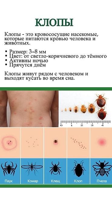 Клининговые услуги: Профессиональная дезинсекция от тараканов — DEZEXPERT Что предлагаем — 7