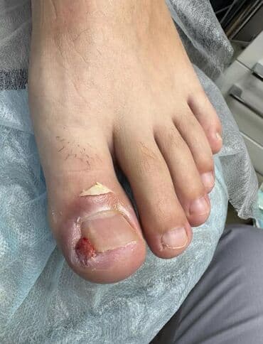 на дом керек: Услуги подолога, С выездом на дом, Консультация, Одноразовые расходные материалы — 7