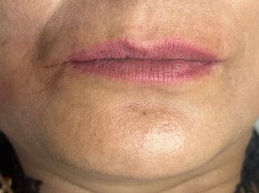 самый лучший эндокринолог рядом просп жибек жолу бишкек: Косметология, Маски, Мезотерапия, Удаление носогубных складок, Гипоаллергенные материалы, Консультация, Сертифицированный косметолог — 7