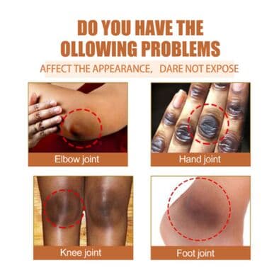 личный кабинет эрсаг кыргызстан: ❄️ США Отбеливать кожу - Масло семян папайи Осветлитель для кожи — 5