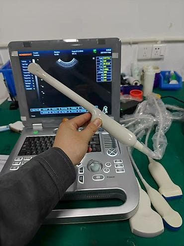 Ингаляторы, небулайзеры: Портативный ультразвуковой аппарат SUNBRIGHT (ноутбучный форм‑фактор) — 3