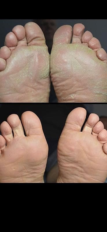 nex 3: Выравнивание, Дизайн, Донаращивание ногтей, Маникюр, Консультация — 4