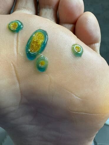 самый лучший эндокринолог рядом просп жибек жолу бишкек: Наращивание ногтей, Укрепление ногтей, Ремонт сломаных ногтей, Маникюр, Педикюр, С выездом на дом, Консультация, Одноразовые расходные материалы — 6