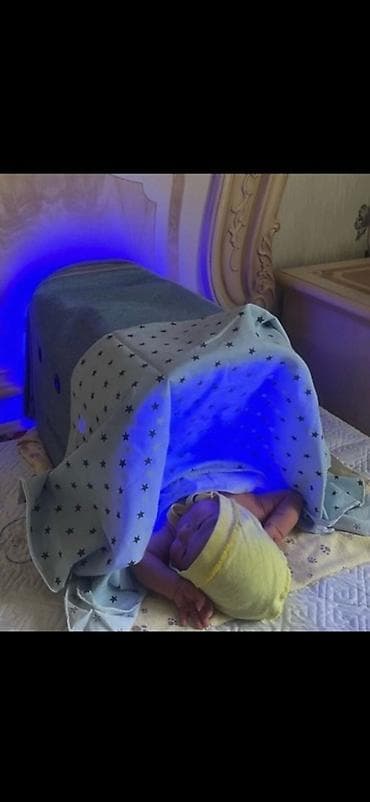 каракол вещи: Фотолампа Аксион для новорождённых 💙 Лечение желтушки дома Безопасная — 5