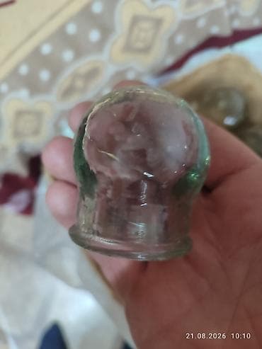 Продаю классические медицинские банки из толстостенного прочного lalafo.kg да Продаю классические медицинские банки из толстостенного прочного