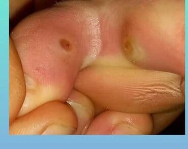 самый лучший эндокринолог рядом просп жибек жолу бишкек: Воосшие ногти, заболевания ногтей, стопы, бородавки, мозоли — 10