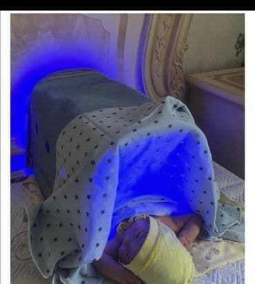 Кислородные концентраторы: Прокат Домашний фототерапевтический бокс для новорождённых — 4