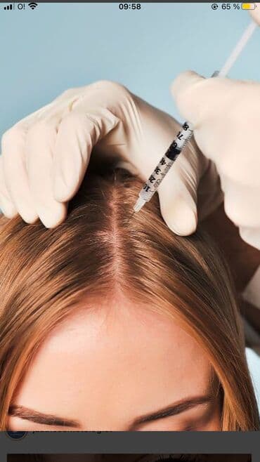 сангапури: Косметология, Брыли, Ботокс, Биоревитализация, Консультация, Гипоаллергенные материалы, Сертифицированный косметолог — 3