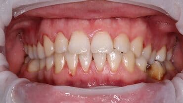 кресло барбер: Клиника | Стоматолог | Протездөө — 2