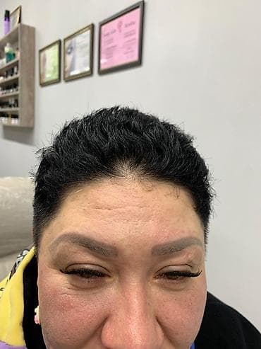 удаление татуажа и татуировок: Лазерное удаление бровей.🌸 Перманентный макияж бровей 🌸 Лазер нового — 9