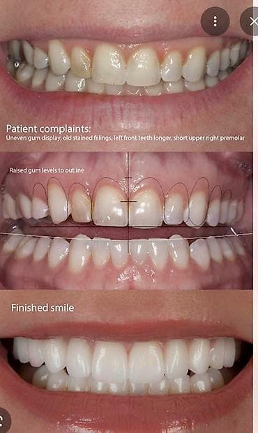 сколько стоит поставить брекеты на зубы: Врачи | Стоматолог | Протезирование, Другие медицинские услуги — 2