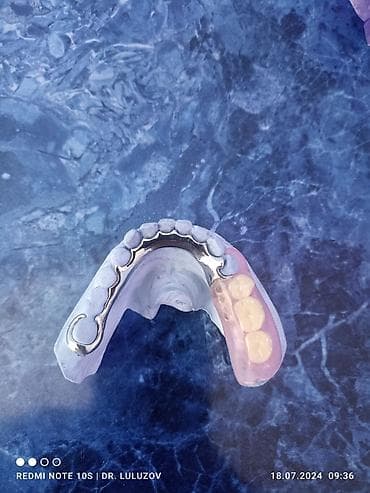 фиксатор голеностоп: Съемные частичные зубные протезы - Тип: частичные протезы для верхней — 10