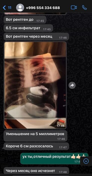 личный кабинет эрсаг кыргызстан: В Китае еще с давних времен используют медведку во благо человека. С — 3