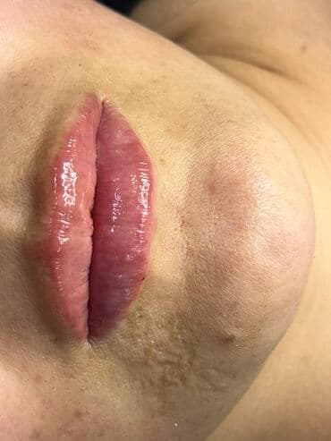 самый лучший эндокринолог рядом просп жибек жолу бишкек: Косметология, Маски, Мезотерапия, Удаление носогубных складок, Гипоаллергенные материалы, Консультация, Сертифицированный косметолог — 5