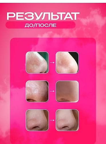 мечит: Аппарат алмазной вакуумной дермобразии — салонная процедура у вас — 2