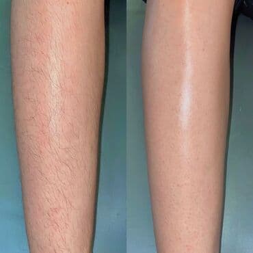 кресло барбер: Шугаринг на все тело — 3