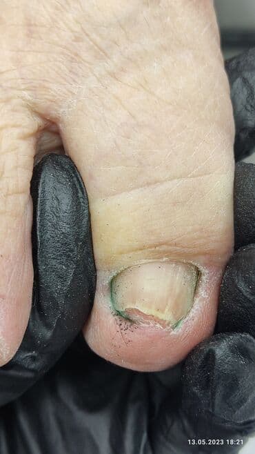 сколько стоит обучение на мастера маникюра: Коррекция вросших ногтей, Маникюр, Педикюр, Услуги подолога, Консультация, Одноразовые расходные материалы — 2