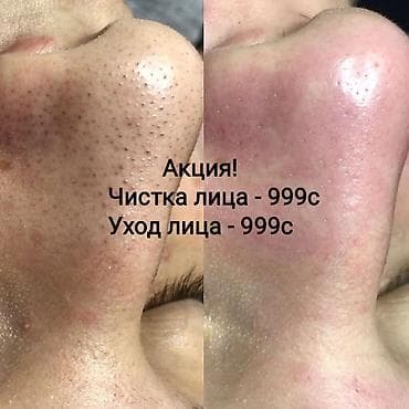 Косметология, Маски, Массаж лица, Отбеливание пигментных пятен, Консультация, Гипоаллергенные материалы, Сертифицированный косметолог