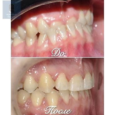 работа для врача: Ортодонтическое лечение: исправление прикуса и выравнивание зубных — 2