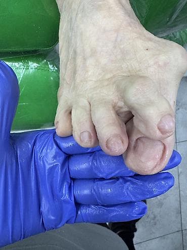 dyson styler: Педикюр, Одноразовые расходные материалы — 8