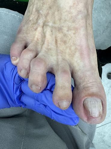 dyson styler: Педикюр, Одноразовые расходные материалы — 10