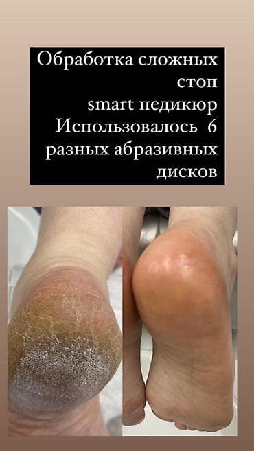 для маникюр: Выравнивание, Дизайн, Донаращивание ногтей, Маникюр, Педикюр, Услуги подолога, Одноразовые расходные материалы, Услуга в 4 руки — 9