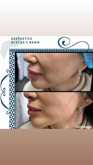 самый лучший эндокринолог рядом просп жибек жолу бишкек: Косметология, Ботокс, Биоревитализация, Ботулинотерапия, Консультация, Гипоаллергенные материалы, Сертифицированный косметолог — 5