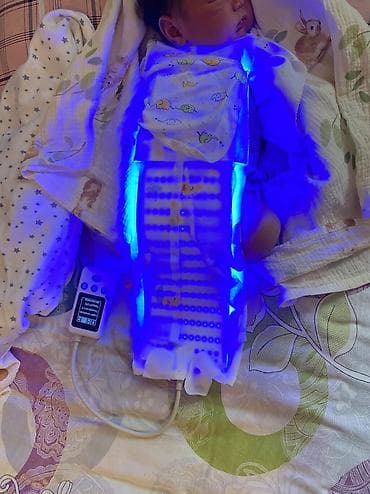 Маски медицинские: Фотолампа коврик от желтушки . Современная светодиодная фотолампа для — 4