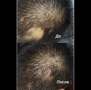 Парфюмерия: Спрей от выпадения волос от алопеции от лысины для роста, густоты — 6