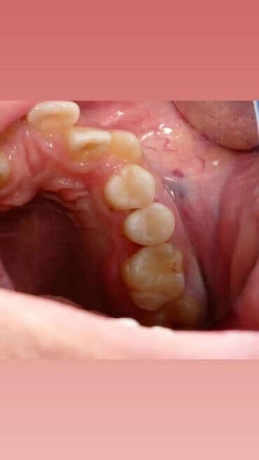 лучший детский стоматолог бишкек: Стоматолог Бишкек. Профессиональная чистка. Лечение кариеса и его — 4