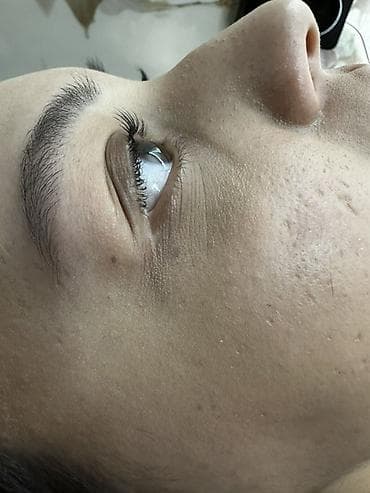 Сулуулук жана ден-соолук: Кирпиктер, Гипоаллергендик материалдар — 4