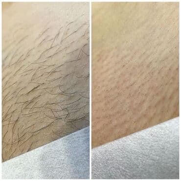 кресло барбер: Шугаринг на все тело — 2