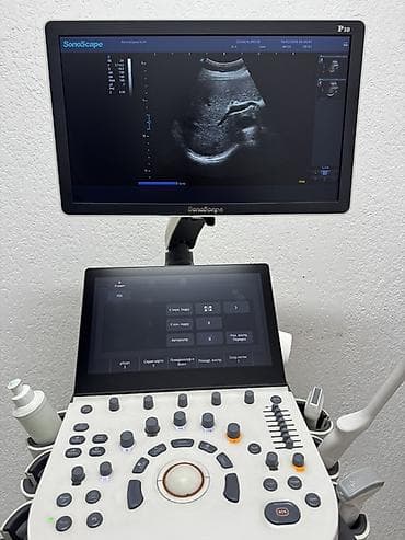 узи скрабер: Продается УЗИ аппарат SonoScape P10 в идеальном состоянии,без — 4