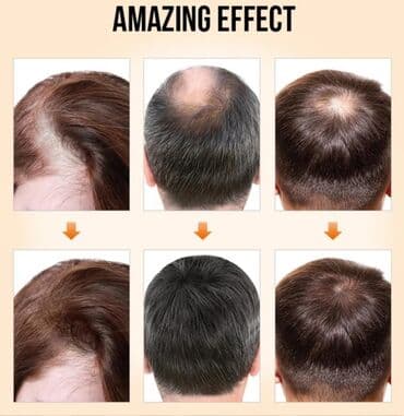 эко спрей от вшей как пользоваться: Натуральное эфирное масло для роста волос PURE. Экстракт имбиря — 5