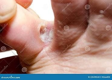 фф бета: Носки с отдельными пальцами (пять пальцев) Размер 35-43 Убирает грибки — 5