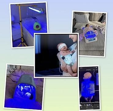 Фотолампа от желтушки коврик, ванночка одеало, арка, кувез бокс lalafo.kg да Фотолампа от желтушки коврик, ванночка одеало, арка, кувез бокс