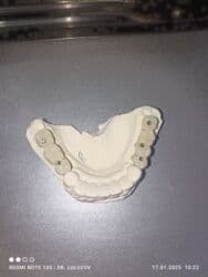 хиджама кровопускание: Клиника | Стоматолог | Протезирование — 19