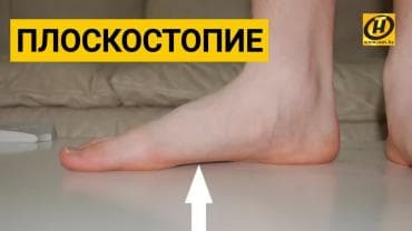 белорусская обувь для проблемных ног бишкек: Стельки ортопедические(специализированные) от плоскостопия! Для — 1