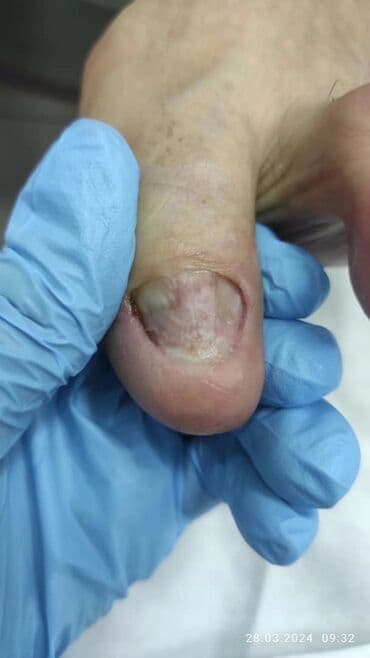 сколько стоит обучение на мастера маникюра: Выравнивание, Наращивание ногтей, Донаращивание ногтей, Маникюр, Педикюр, Услуги подолога, Консультация, Одноразовые расходные материалы — 6